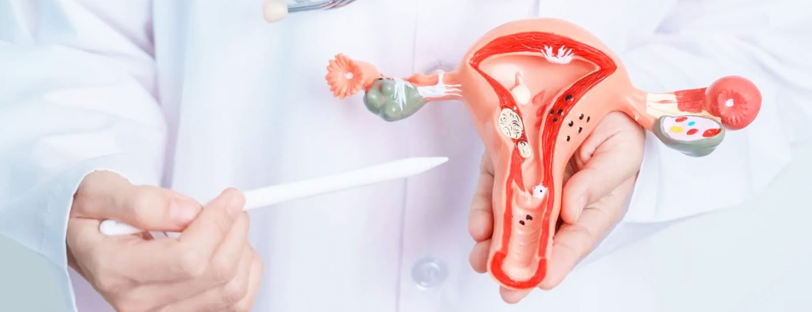 PCOS Nutrition Plan